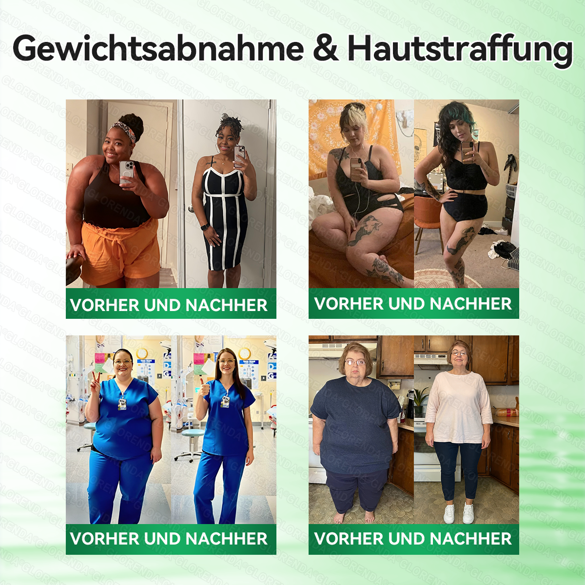 🇩🇪𝐎𝐟𝐟𝐢𝐳𝐢𝐞𝐥𝐥𝐞𝐫 𝐒𝐡𝐨𝐩 |🎉🎉𝑮𝑳𝑶𝐑𝐄𝐍𝐃𝘼®𝙈𝙤𝙧𝙞𝙣𝗴𝗮 · 𝗕𝗲𝗿𝗯𝗲𝗿𝒊𝒏 × 𝑵𝘼𝘿+ 10-𝙞𝙣-𝟏 𝐀𝐝𝐯𝐚𝗻𝗰𝗲𝗱 𝗡𝗮𝙣𝙤 𝙈𝙞𝙠𝙧𝐨𝐧𝐚𝐝𝐞𝐥-𝐏𝐚𝒕𝒄𝗵(𝐍𝐮𝐫 𝐞𝐢𝐧𝐦𝐚𝐥 𝐭ä𝐠𝐥𝐢𝐜𝐡, 𝐬𝐢𝐜𝐡𝐭𝐛𝐚𝐫𝐞 𝐕𝐞𝐫ä𝐧𝐝𝐞𝐫𝐮𝐧𝐠𝐞𝐧 𝐢𝐧 𝟕 𝐓𝐚𝐠𝐞𝐧)✅ 𝐅ü𝐫 𝐅𝐞𝐭𝐭𝐥𝐞𝐢𝐛𝐢𝐠𝐤𝐞𝐢𝐭, 𝐇𝐚𝐮𝐭𝐬𝐭𝐫𝐚𝐟𝐟𝐮𝐧𝐠, 𝐃𝐢𝐚𝐛𝐞𝐭𝐞𝐬, 𝐒𝐜𝐡𝐥𝐚𝐟𝐚𝐩𝐧𝐨𝐞, 𝐆𝐞𝐥𝐞𝐧𝐤𝐩𝐫𝐨𝐛𝐥𝐞𝐦𝐞 𝐮𝐧𝐝 𝐦𝐞𝐡𝐫!