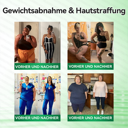🇩🇪𝐎𝐟𝐟𝐢𝐳𝐢𝐞𝐥𝐥𝐞𝐫 𝐒𝐡𝐨𝐩 |🎉🎉𝑮𝑳𝑶𝐑𝐄𝐍𝐃𝘼®𝙈𝙤𝙧𝙞𝙣𝗴𝗮 · 𝗕𝗲𝗿𝗯𝗲𝗿𝒊𝒏 × 𝑵𝘼𝘿+ 10-𝙞𝙣-𝟏 𝐀𝐝𝐯𝐚𝗻𝗰𝗲𝗱 𝗡𝗮𝙣𝙤 𝙈𝙞𝙠𝙧𝐨𝐧𝐚𝐝𝐞𝐥-𝐏𝐚𝒕𝒄𝗵(𝐍𝐮𝐫 𝐞𝐢𝐧𝐦𝐚𝐥 𝐭ä𝐠𝐥𝐢𝐜𝐡, 𝐬𝐢𝐜𝐡𝐭𝐛𝐚𝐫𝐞 𝐕𝐞𝐫ä𝐧𝐝𝐞𝐫𝐮𝐧𝐠𝐞𝐧 𝐢𝐧 𝟕 𝐓𝐚𝐠𝐞𝐧)✅ 𝐅ü𝐫 𝐅𝐞𝐭𝐭𝐥𝐞𝐢𝐛𝐢𝐠𝐤𝐞𝐢𝐭, 𝐇𝐚𝐮𝐭𝐬𝐭𝐫𝐚𝐟𝐟𝐮𝐧𝐠, 𝐃𝐢𝐚𝐛𝐞𝐭𝐞𝐬, 𝐒𝐜𝐡𝐥𝐚𝐟𝐚𝐩𝐧𝐨𝐞, 𝐆𝐞𝐥𝐞𝐧𝐤𝐩𝐫𝐨𝐛𝐥𝐞𝐦𝐞 𝐮𝐧𝐝 𝐦𝐞𝐡𝐫!
