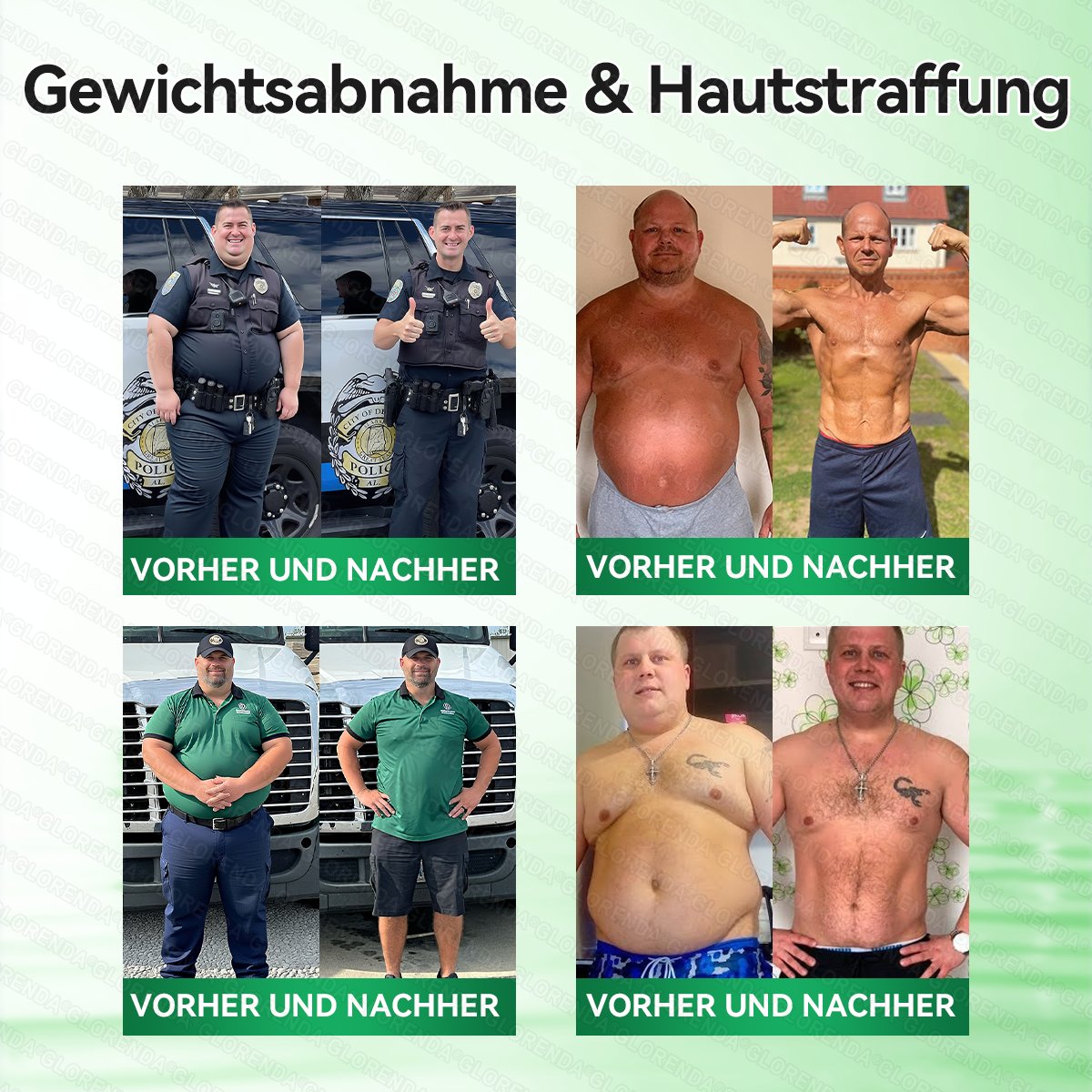 🇩🇪𝐎𝐟𝐟𝐢𝐳𝐢𝐞𝐥𝐥𝐞𝐫 𝐒𝐡𝐨𝐩 |🎉🎉𝑮𝑳𝑶𝐑𝐄𝐍𝐃𝘼®𝙈𝙤𝙧𝙞𝙣𝗴𝗮 · 𝗕𝗲𝗿𝗯𝗲𝗿𝒊𝒏 × 𝑵𝘼𝘿+ 10-𝙞𝙣-𝟏 𝐀𝐝𝐯𝐚𝗻𝗰𝗲𝗱 𝗡𝗮𝙣𝙤 𝙈𝙞𝙠𝙧𝐨𝐧𝐚𝐝𝐞𝐥-𝐏𝐚𝒕𝒄𝗵(𝐍𝐮𝐫 𝐞𝐢𝐧𝐦𝐚𝐥 𝐭ä𝐠𝐥𝐢𝐜𝐡, 𝐬𝐢𝐜𝐡𝐭𝐛𝐚𝐫𝐞 𝐕𝐞𝐫ä𝐧𝐝𝐞𝐫𝐮𝐧𝐠𝐞𝐧 𝐢𝐧 𝟕 𝐓𝐚𝐠𝐞𝐧)✅ 𝐅ü𝐫 𝐅𝐞𝐭𝐭𝐥𝐞𝐢𝐛𝐢𝐠𝐤𝐞𝐢𝐭, 𝐇𝐚𝐮𝐭𝐬𝐭𝐫𝐚𝐟𝐟𝐮𝐧𝐠, 𝐃𝐢𝐚𝐛𝐞𝐭𝐞𝐬, 𝐒𝐜𝐡𝐥𝐚𝐟𝐚𝐩𝐧𝐨𝐞, 𝐆𝐞𝐥𝐞𝐧𝐤𝐩𝐫𝐨𝐛𝐥𝐞𝐦𝐞 𝐮𝐧𝐝 𝐦𝐞𝐡𝐫!