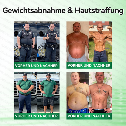 🇩🇪𝐎𝐟𝐟𝐢𝐳𝐢𝐞𝐥𝐥𝐞𝐫 𝐒𝐡𝐨𝐩 |🎉🎉𝑮𝑳𝑶𝐑𝐄𝐍𝐃𝘼®𝙈𝙤𝙧𝙞𝙣𝗴𝗮 · 𝗕𝗲𝗿𝗯𝗲𝗿𝒊𝒏 × 𝑵𝘼𝘿+ 10-𝙞𝙣-𝟏 𝐀𝐝𝐯𝐚𝗻𝗰𝗲𝗱 𝗡𝗮𝙣𝙤 𝙈𝙞𝙠𝙧𝐨𝐧𝐚𝐝𝐞𝐥-𝐏𝐚𝒕𝒄𝗵(𝐍𝐮𝐫 𝐞𝐢𝐧𝐦𝐚𝐥 𝐭ä𝐠𝐥𝐢𝐜𝐡, 𝐬𝐢𝐜𝐡𝐭𝐛𝐚𝐫𝐞 𝐕𝐞𝐫ä𝐧𝐝𝐞𝐫𝐮𝐧𝐠𝐞𝐧 𝐢𝐧 𝟕 𝐓𝐚𝐠𝐞𝐧)✅ 𝐅ü𝐫 𝐅𝐞𝐭𝐭𝐥𝐞𝐢𝐛𝐢𝐠𝐤𝐞𝐢𝐭, 𝐇𝐚𝐮𝐭𝐬𝐭𝐫𝐚𝐟𝐟𝐮𝐧𝐠, 𝐃𝐢𝐚𝐛𝐞𝐭𝐞𝐬, 𝐒𝐜𝐡𝐥𝐚𝐟𝐚𝐩𝐧𝐨𝐞, 𝐆𝐞𝐥𝐞𝐧𝐤𝐩𝐫𝐨𝐛𝐥𝐞𝐦𝐞 𝐮𝐧𝐝 𝐦𝐞𝐡𝐫!